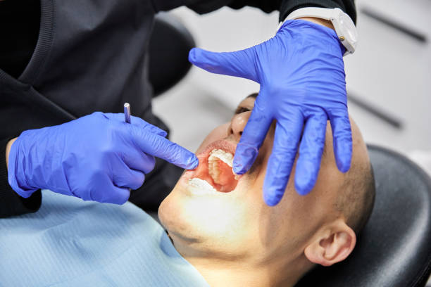 Best Emergency Dental Care for Broken or Chipped Teeth in Kahului, HI